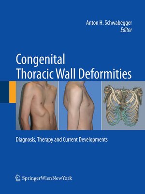 cover image of Congenital Thoracic Wall Deformities